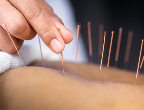 Does Acupuncture Hurt or Cause Pain